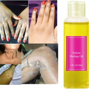 Yellow Peeling Oil Extra Strong Whitening Bleaching Dark Skin Spots Blackheads Blemishes Bad Skin Remover For Body Treatment Gel