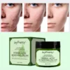 Anti-acne Cream Treatment Cream Blackhead Acne Cream Repair Gel Oil Control Shrink Pores Scar Facial Care Whitening Skin
