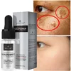 Effective Whitening Serum Remove Dark Spots Freckle Essence Anti-Aging Niacinamide Fade Pigmentation Melasma Brighten Skin Care