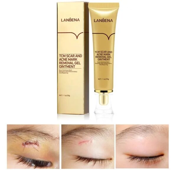 Ance Scar Removal Cream Moisturizing Whitening Cream Gel Ointment Effectively Repair Stretch Marks Scar Skin Care