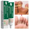 Herbal Foot Fungus Removal Cream Nail Care Ointment Anti Fungal Infection Onychomycosis Paronychia Toe Fungus Repair Feet Care
