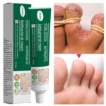 Herbal Foot Fungus Removal Cream Nail Care Ointment Anti Fungal Infection Onychomycosis Paronychia Toe Fungus Repair Feet Care