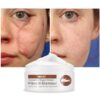 Crocodile Repair Scar Acne Cream Facial Treatment Repair Cream Stretch Marks Treatment Whitening Day Creams