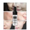 Effective Whitening Serum Remove Dark Spots Freckle Essence Anti-Aging Niacinamide Fade Pigmentation Melasma Brighten Skin Care