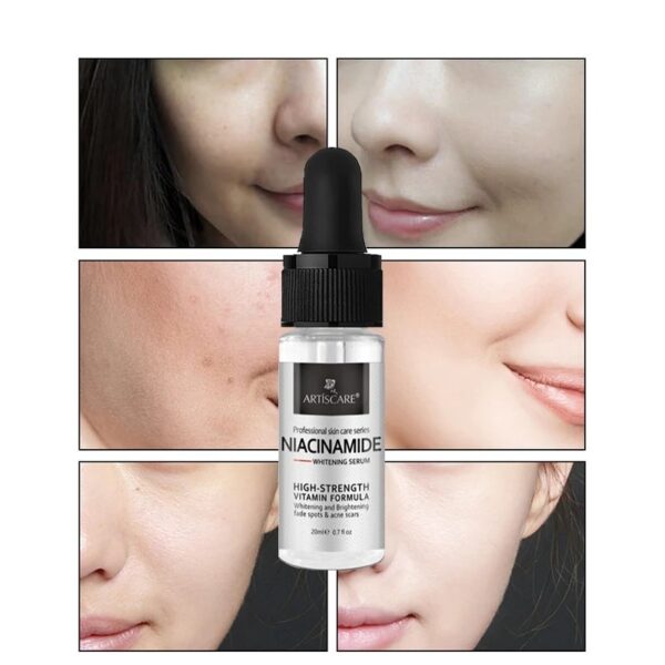 Effective Whitening Serum Remove Dark Spots Freckle Essence Anti-Aging Niacinamide Fade Pigmentation Melasma Brighten Skin Care