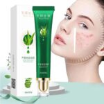 Effective Acne Removal Cream Acne Treatment Fade Acne Spots Oil Control Shrink Pores Whitening Moisturizing Acne Cream Skin Care
