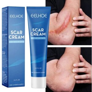 Acne Scar Removal Cream Gel Skin Care Stretch Marks Remove Acne Spots Surgical Scars Treatment Smooth Whitening Beauty Cosmetics