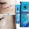 Herbal Scar Removal Cream Stretch Marks Treatment Pimples Spots Repair Gel Promote Cell Regeneration Natural Plaster Skin Care