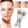 Whitening Freckle Cream Remove Melasma Cream Remove Dark Spots Melanin Melasma Remover Brighten Moisturizing Skin Care
