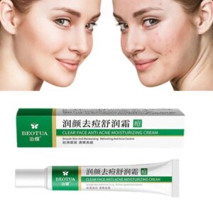 Acne Treatment Gel Skin Care Face Cream Herbal Acne Removal Cream Whitening Moisturizing Shrink Pores Oil Control Pimples