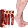 Veins Cream Remover Pain Relief Cream Phlebitis Spider Legs Herb Plaster Personal Beauty Body Care