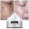 Freckle Cream Remove Melanin Color Patch Plaque Spots Removal Brighten Pigment Moisturizing Whitening Skin Care