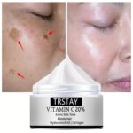 Freckle Cream Remove Melanin Color Patch Plaque Spots Removal Brighten Pigment Moisturizing Whitening Skin Care