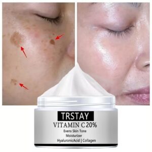 Freckle Cream Remove Melanin Color Patch Plaque Spots Removal Brighten Pigment Moisturizing Whitening Skin Care