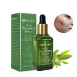 Acne Removal Serum Treatment Acne Scar Spots Pimple Shrink Pores Oil Control Whitening Moisturizing Repair Facial Essence