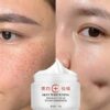 Best quality whitening cream dark spot remover cream face pigment melasma and freckles removal cream