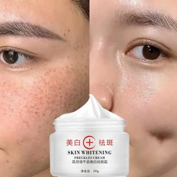 Best quality whitening cream dark spot remover cream face pigment melasma and freckles removal cream