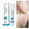 Scar Removal Cream Gel Repaire Pock Mark Burn Surgical Scar Cesarean Scar Stretch Mark Treatment Smooth Moisturize Skin Care