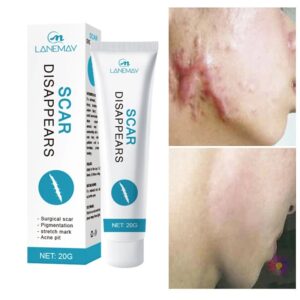 Scar Removal Cream Gel Repaire Pock Mark Burn Surgical Scar Cesarean Scar Stretch Mark Treatment Smooth Moisturize Skin Care