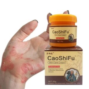Dermatitis Ointment Treatment Psoriasi Eczema Cream Eczematoid Ointment Effective Antipruritic Skin Repair Cream