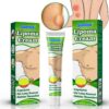Lipoma Ointment Lipoma Treatment Cream Fat Granule Care Cream External Skin Care Skin Swelling Cellulite Ointment