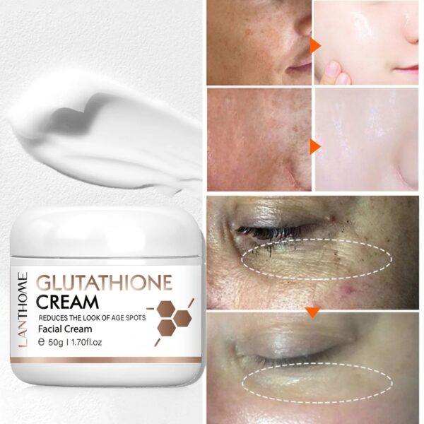 Glycyrrhiza glabra Whitening Freckle Cream Dark Spot Remover Skin Care Moisturizing Brighten Pigment Correction Face Beauty