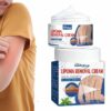 Lipoma Removal Cream Herbal Extract Treatment Fat Bulges Lump Remove Subcutaneous Lump Relief Swelling Fat Elimination Cream 50g
