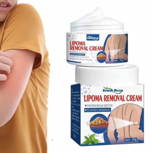 Lipoma Removal Cream Herbal Extract Treatment Fat Bulges Lump Remove Subcutaneous Lump Relief Swelling Fat Elimination Cream 50g