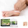 Effective Acne Scar Removal Cream Pimples Stretch Marks Surgical Burn Scar Pigmentation Corrector Smoothing Whitening Body Care