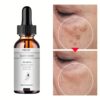 Acid Turmeric Face Serum Whitening Dark Spot Remover Acne Scar Bright Skin Corrector Facial Essence Improve Roughness