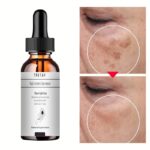 Acid Turmeric Face Serum Whitening Dark Spot Remover Acne Scar Bright Skin Corrector Facial Essence Improve Roughness