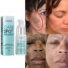 Whitening Cream Freckle Dark Spot Remover Nicotinamide Moisturizing Brighten Lighten Pigment Correction Face Beauty Skin Care