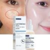 Face Serum Remove Blackhead Anti-Acne Smooth Pores Repair Essence Whitening Moisturizing Skin Care