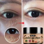 Effective Removes Fat Granules Eyes Cream Improve Eye Bag Fine Lines Moisturizing Anti-Puffiness Lifting Firming Eye Care Serum