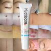 Anti Spot Cream Face Gel Acne Marks Removal Cream Blackhead Removal Striae Gravidarum Pigmentation Corrector Gel