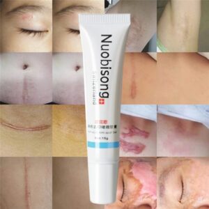 Anti Spot Cream Face Gel Acne Marks Removal Cream Blackhead Removal Striae Gravidarum Pigmentation Corrector Gel