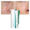 Scar Cream Face Pimples Scar Stretch Marks Removal Whitening Moisturizing Cream Skin Care  Face Cream Skin Repair