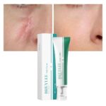 Scar Cream Face Pimples Scar Stretch Marks Removal Whitening Moisturizing Cream Skin Care  Face Cream Skin Repair
