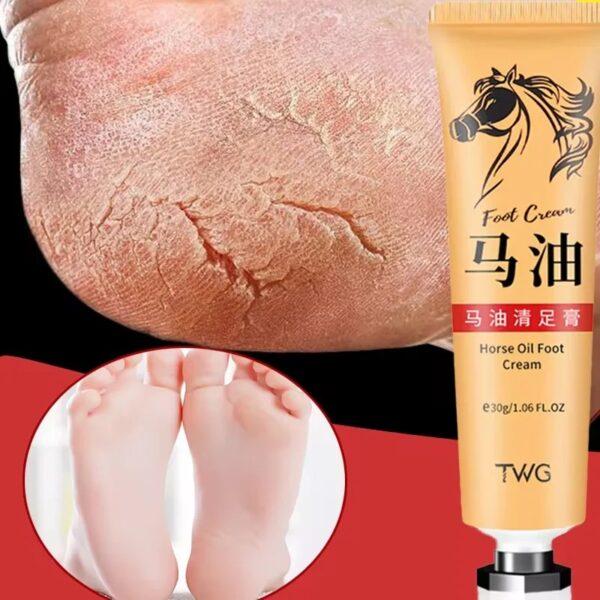 Anti-Cracking Foot Cream Heel Crack Repair Horse Oil Ointment Foot Cream To Remove Dead Skin Calluses Hand And Foot Skin Care