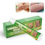 Varicose Vein Cream Repair Swelling Legs Pain Relief Cream Varicose Vein Remover Korean Skin Care Products Beauty Health