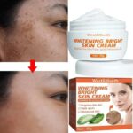 Powerful Whitening Freckle Cream Remove Acne Spots Melanin Dark Spots Face Lift Firming Face Skin Care Beauty Essentials