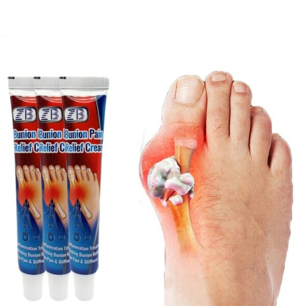 Gout Treatment Ointment Hallux Valgus Bunion Toe Swelling Pain Relief Ointment Joint Arthritis Medical Plaster