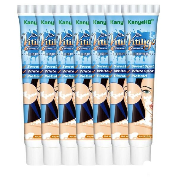 Herbal Extract Vitiligo Ointment Remove Ringworm White Spot Removal Skin White Spot Leukoplakia