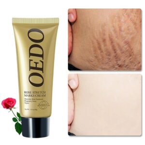 Rose Removes Stretch Mark Cream To Remove Postpartum Obesity Pregnant Women Repair Anti-Aging Anti-Winkles Firming Body Cream