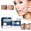 Effective Acne Scar Removal Cream Stretch  Corrector Smoothing Whitening Body Care