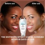Skin Bleaching Cream For Black Dark Skin Lightening Body Lotion Moisturizing Dry Skin Cream Crotch Intimate Parts Bleach