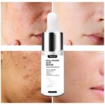 Acid for Face Serum Moisturizing Whitening Facial Essence Face Cream Repair Anti Aging Lifting Firming Skin Care