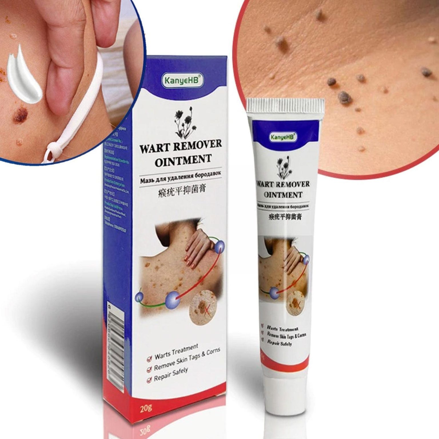 Wart Remover Ointment Genital Herpes Genital Vulva Remover Treatment Skin Antibacterial 4739