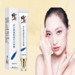 Whitening Freckle Cream Melasma freckles sunburn pregnancy spot cream remove Fade Pigmentation Skin Anti-Aging Skin Care