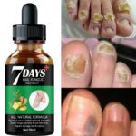 Accelerate Nail Growth Essential Oils Fungus Elimination Nail Fungus Treatment Care Hand Foot Care Removal Repair